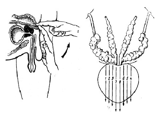 Техника массажа простаты